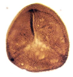 Apiculiretusispora sp., spore diameter approximately 40μm (Copyright owned by University of Sheffield).