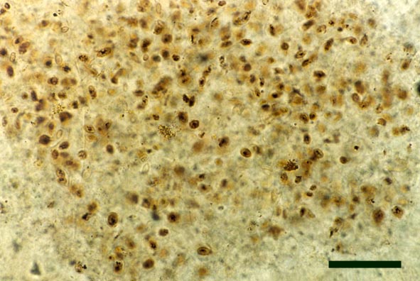 A number of unicells in Rhynie chert. Some of these displaying cell contents may represent unicellular eukaryotic algae (scale bar = 50µm).