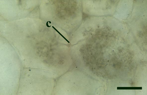 Cortical cells of Aglaophyton major with well developed arbuscles. The places where the fungus penetrated the cell wall are shown (c) (scale bar = 20μm) (Copyright owned by University of Münster).