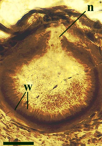 Mature perithecium in a stomatal chamber of Asteroxylon. This shows the two layers of the wall (w) and the opening through which the ascospores are released (n).(scale bar = 100μm) (Copyright owned by University of Münster).