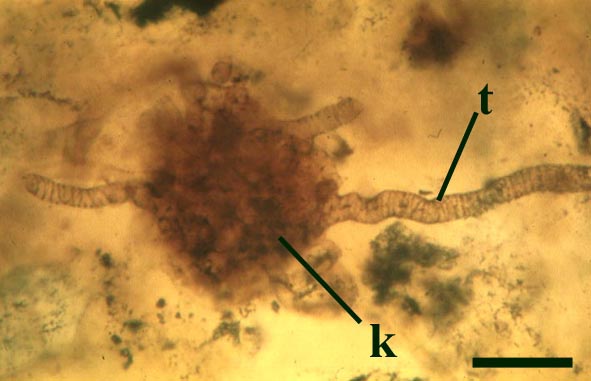 Another branch knot (k) of Nematoplexus with emerging tubes with spiral thickenings (t) (scale bar = 100µm) (Copyright owned by University of Münster).