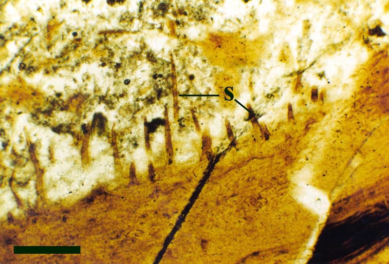 Longitudinal section of an aerial axis showing conspicuous unicellular spinose projections (s) (scale bar = 500µm).