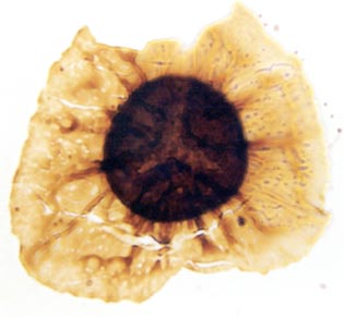 A zonate spore, diameter approximately 50μm (Copyright owned by University of Sheffield).
