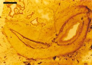 A medially flattened sporangium of Asteroxylon (scale bar = 1mm).