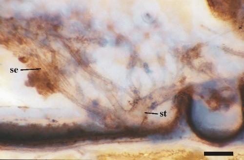 Longitudinal view through the anterior opisthosoma of a female (posterior-most leg coxa to the right) showing the stem trachea (st) and secondary trachea (se) (scale bar = 200mm) (Copyright owned by University of Münster).