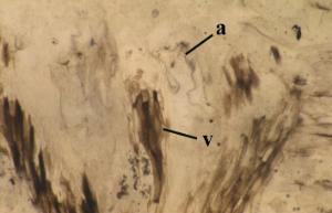 Thin section of the female gametophyte Langiophyton mackiei showing vascular strand (v) and the tubular outgrowths bearing the archegonia (a) (Copyright owned by University of Münster).