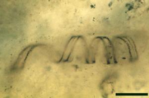 A spirally coiled smooth-walled tube of Nematoplexus (scale bar = 50µm) (Copyright owned by University of Münster).