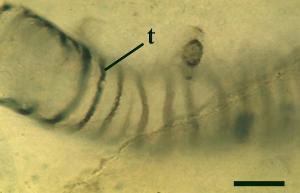 A thin-walled tube of Nematoplexus with spiral thickenings (t) (scale bar = 10µm) (Copyright owned by University of Münster).