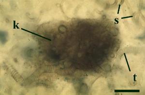 Taken from the holotype of Nematoplexus rhyniensis, this image shows a typical branch knot (k) with tubes with thickenings (t). Smooth tubes (s) are also shown (scale bar = 100µm) (Copyright owned by University of Münster).