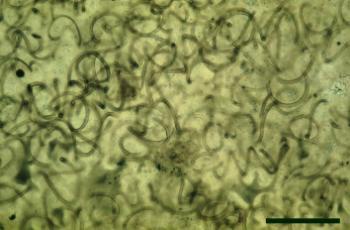 Nematoplexus rhyniensis showing typical open meshwork of spirally coiled tubular cells (scale bar = 200µm) (Copyright owned by University of Münster).