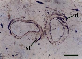 Two empty sporangia of Nothia aphylla the left one showing the sporangial stalk (st). The dehiscence slit is also evident (d) (scale bar = 1mm).