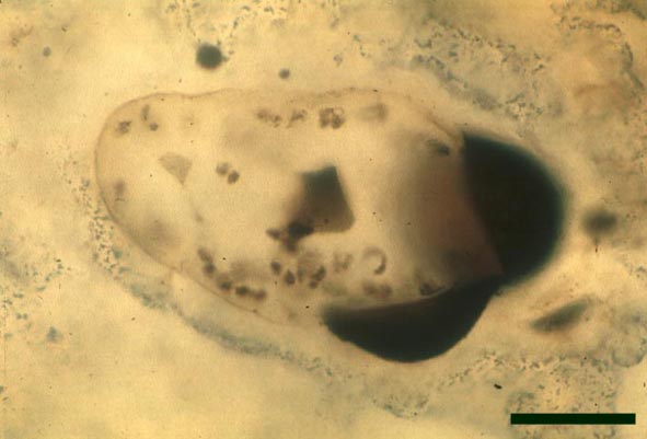 Preservation at further stages of embryo development (scale bar = 50μm) (Copyright owned by University Münster)