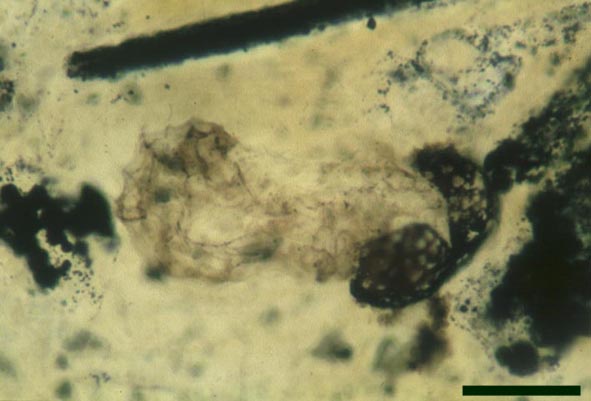 Preservation at further stages of embryo development (scale bar = 50μm) (Copyright owned by University Münster)