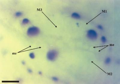 Close up of the right lateral eye tubercle of Palaeocharinus tuberculatus showing the eye lenses. The dark circles are tubercles, a characteristic feature of this particular species. Me: minor eye lenses, M1-3: major eye lenses (scale bar = 100 μm).