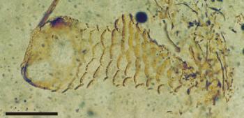 Fragment of trigonotarbid cuticle in chert showing the distinctive scale-like sculpture (scale bar = 50 μm).