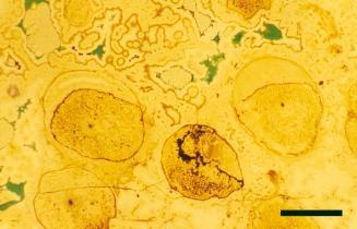 Partially decayed axes of Rhynia gwynne-vaughanii that have shrunken away from the cuticle before being silicified (scale bar = 2mm).