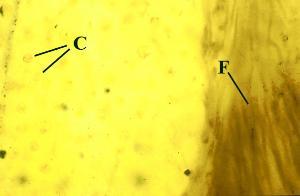 Close-up of thallus showing tightly aggregated hyphae (F) and one of the surface 'pockets' containing a fine net of hyphae enclosing cells of the photobiont (C) (Copyright owned by University of Münster).