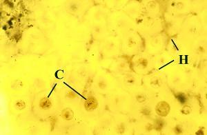 Close-up of 'net' showing fungal hyphae (H) enclosing cells of the photobiont (C) (Copyright owned by University of Münster).