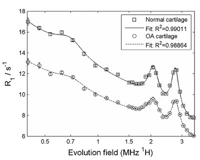 Cartilage relaxometry