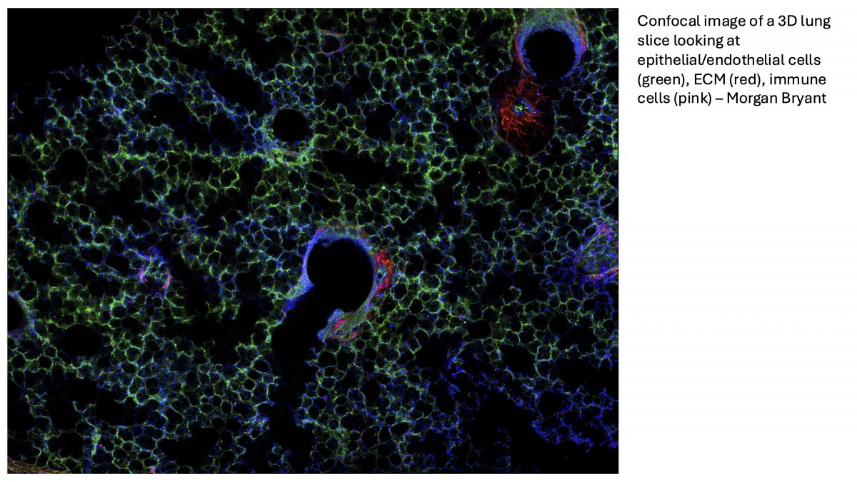 fluorescent image of 3D lung slice showing structure, cells and ECM