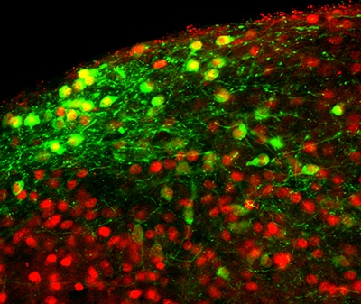 Cells in the brain that impact appetite