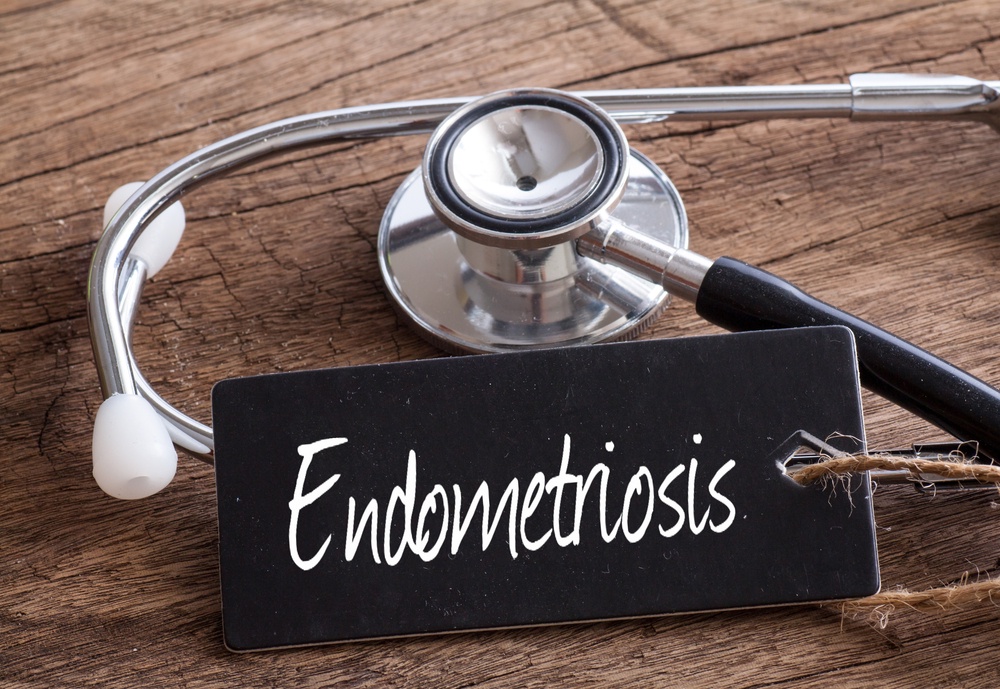 endometroisis image