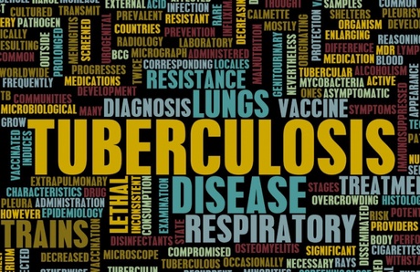 New research identified those mot susceptible to TB