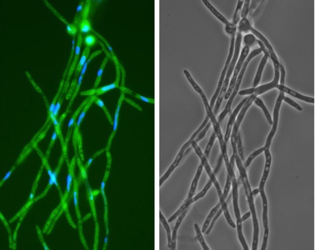 Candida hyphal cells labelled with a green fluorescent protein