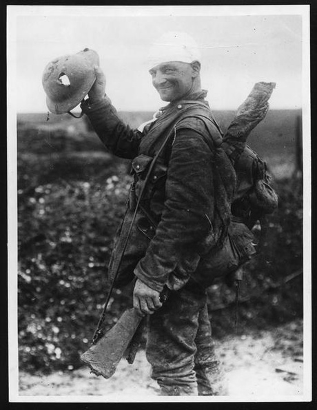 Shows a soldier shot in the head who he was saved by his helmet. This photo is courtesy of the National Library of Scotland.