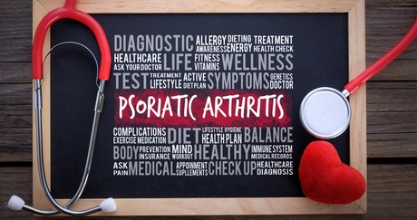 A new study will look at the impact of new drugs on people with psoriatic arthritis