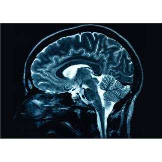 Scientists have estimated for the first time the extent to which genes determine changes in intelligence across the human life course