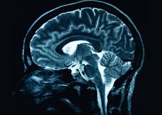 Faster and more detailed imaging of brain disorders will be on the way thanks to the efforts of a local charity