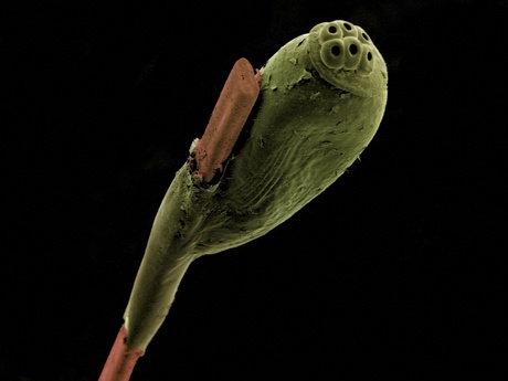 Head louse egg on human hair captured by Kevin Mackenzie