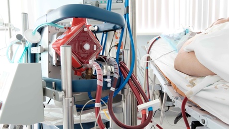 ECMO equipment alongside a patient in a hospital bed