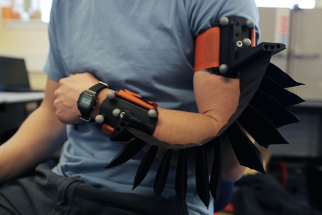 A close up image of a piece of specialised physiotherapy equipment worn on the arm