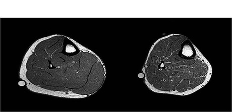 MRI image