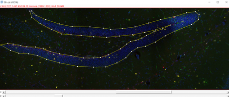 Using Fiji to visualise cells