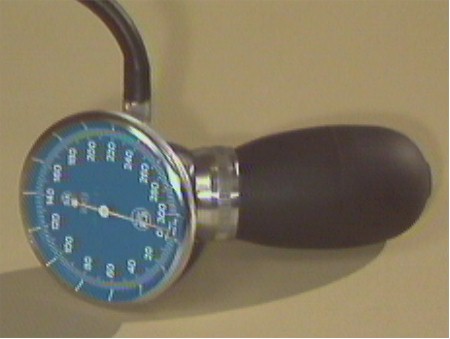 Photo of anaeroid sphygmomanometer