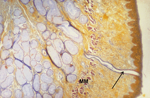 Oesophagus