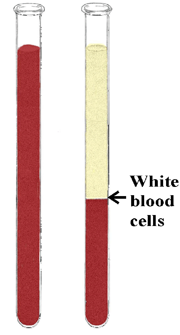 Blood Cells