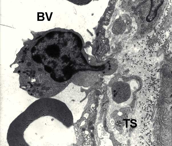 Lymphocytes - 3