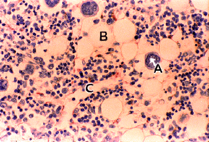 Bone Marrow - 2