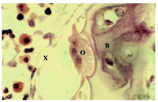 Electron Micrograph of Bone