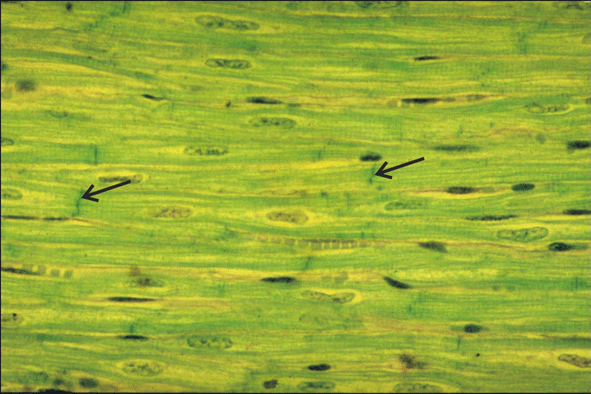 Mircrograph of An Area of Myocardium