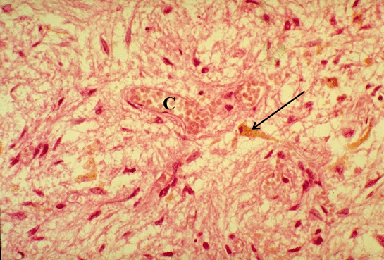 The Posterior Pituitary