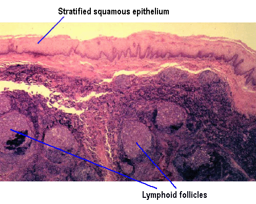 Palatine Tonsil