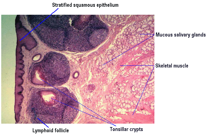 Lingual Tonsil