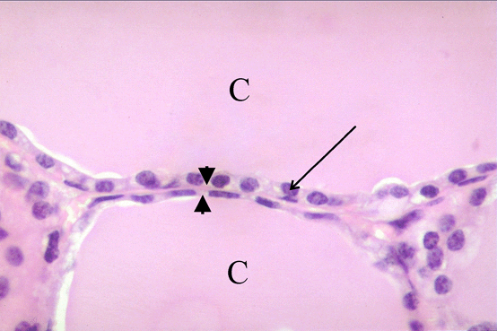 Thyroid Gland 2