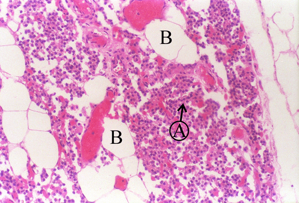 Parathyroid Gland - Age Changes