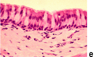 Micrograph A